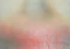 face