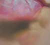 face